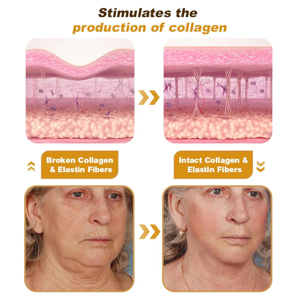 BOTOX - Bee Venom Wrinkle Repair Cream 🐝✨